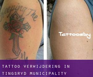 Tattoo verwijdering in Tingsryd Municipality